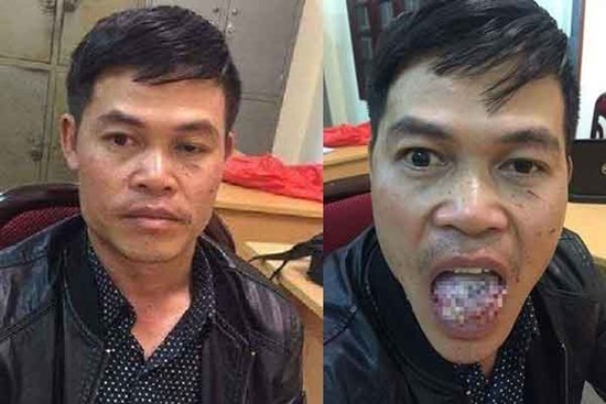 Hành trình tội lỗi của kẻ hiếp dâm nữ sinh rồi bị cắn đứt lưỡi