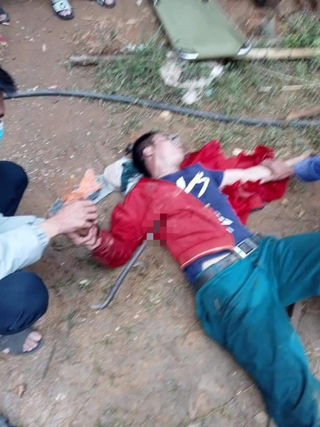 Rơi từ trên mái nhà xuống, thanh niên bị thanh xà beng đâm xuyên qua ngực-1