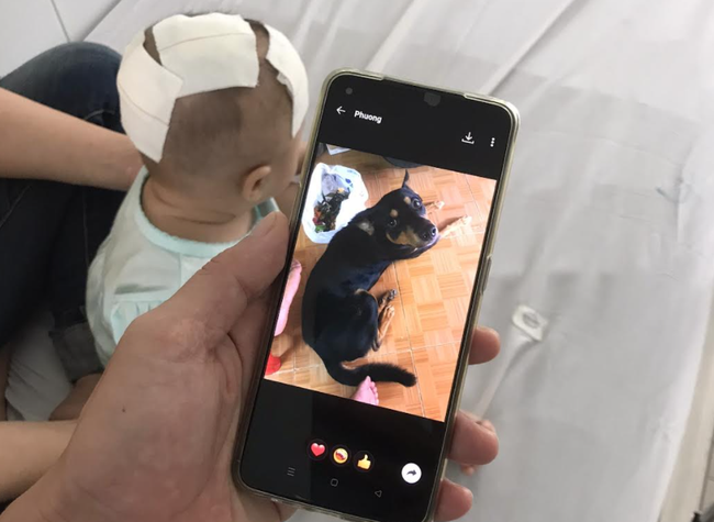 Bé 6 tháng tuổi bị chó cưng cắn xuyên sọ, đây là 10 lưu ý sống còn trước khi cha mẹ quyết định nuôi chó mèo nếu nhà có con nhỏ-1