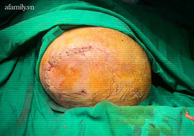 Bé 6 tháng tuổi bị chó cưng cắn xuyên sọ, đây là 10 lưu ý sống còn trước khi cha mẹ quyết định nuôi chó mèo nếu nhà có con nhỏ-2