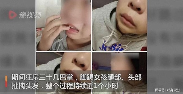 Bé gái lớp 8 đang yên đang lành bị phó hiệu trưởng tát 30 cái liên tục vào mặt, chi tiết hành vi bạo lực gây căm phẫn-1