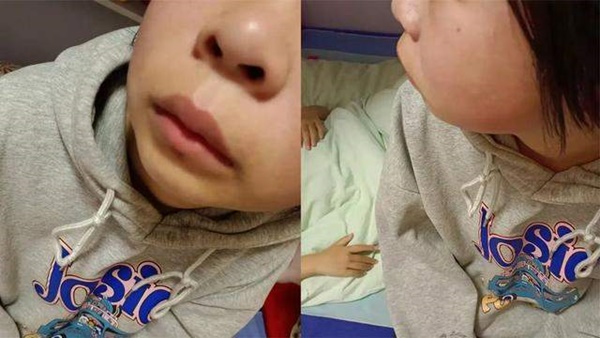 Bé gái lớp 8 đang yên đang lành bị phó hiệu trưởng tát 30 cái liên tục vào mặt, chi tiết hành vi bạo lực gây căm phẫn-2