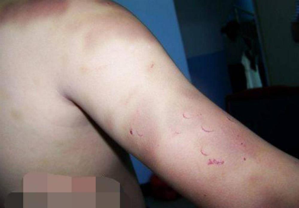 Mỗi khi anh trai bế, em gái đều khóc to: Nguyên nhân khiến người mẹ không ngừng tự trách-2