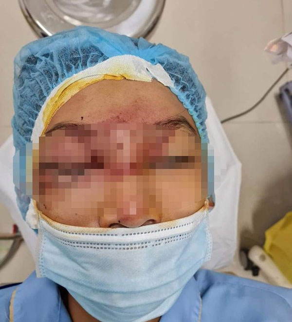 Mẹ bơm xe bị nổ lốp, mảnh vỡ làm hỏng mắt con trai-1