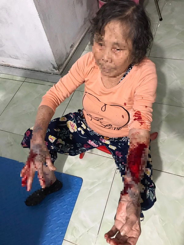 Góp ý hàng xóm hát karaoke quá to, cụ bà 83 tuổi bị đánh nhập viện-1