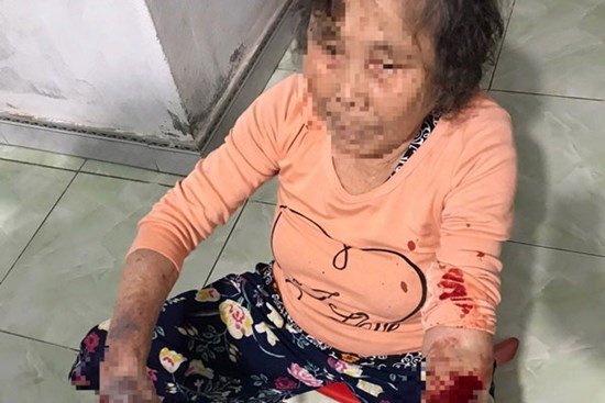 Góp ý hàng xóm hát karaoke quá to, cụ bà 83 tuổi bị đánh nhập viện