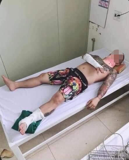 Xôn xao thánh chửi Dương Minh Tuyền bị giang hồ đánh trọng thương, nhập viện trong đêm ở Bắc Ninh-3
