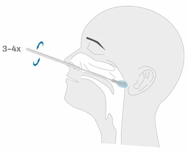 Tiếp xúc F0 sau bao lâu cần test nhanh Covid-19?-2