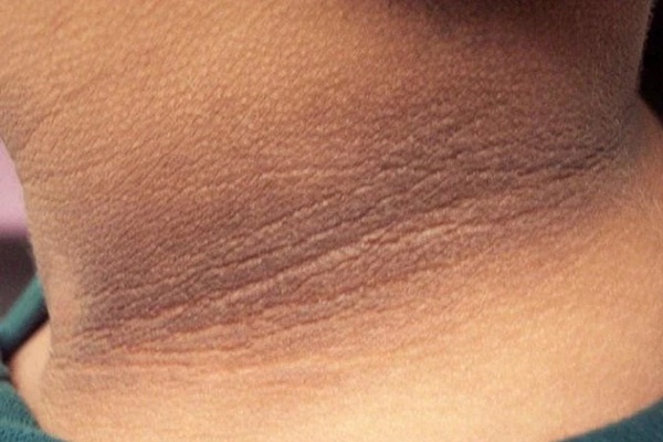 Ung thư dạ dày đặc biệt thích 3 kiểu người này, mong rằng bạn không thuộc bất kỳ nhóm nào-4