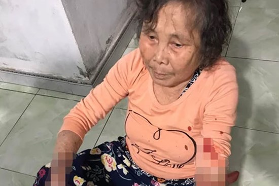 Triệu tập người đánh cụ bà khi bị nhắc mở nhạc lớn