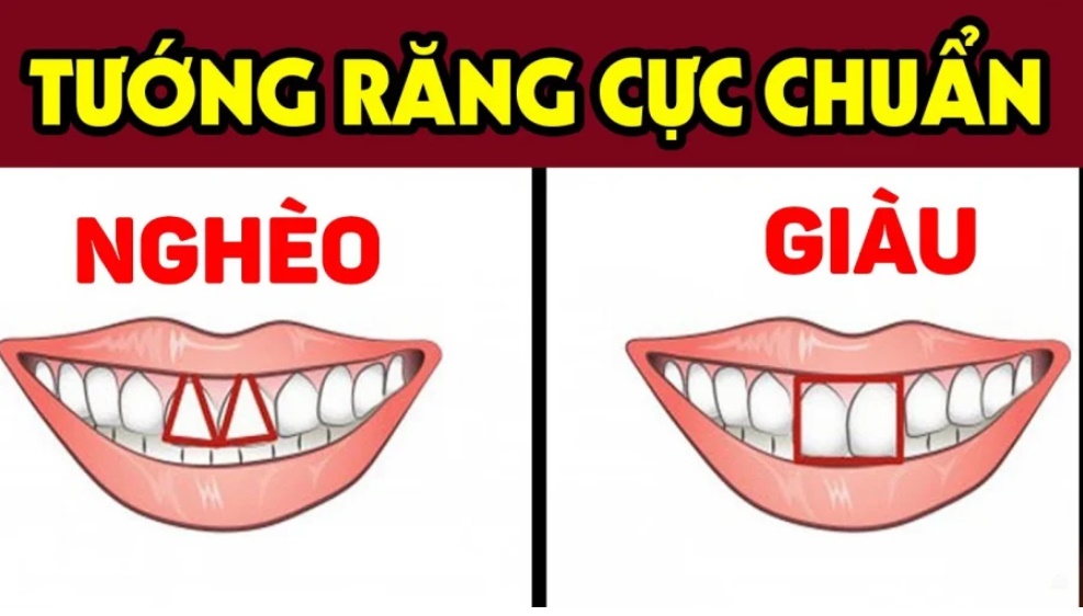 Dù nam hay nữ nếu sở hữu 4 tướng răng này thường nghèo khổ, tình duyên lận đận, dễ cô độc khi về già-1