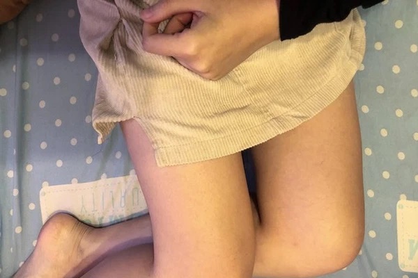 Người phụ nữ bị ngứa ngáy, viêm loét vùng kín phải nhập viện vì 1 sai lầm phổ biến khi dùng băng vệ sinh của chị em ưa sạch sẽ-2