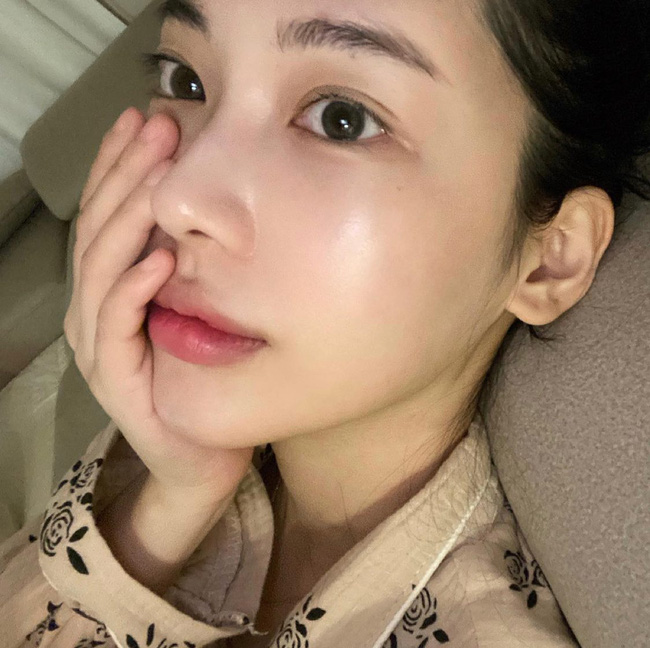 Bác sĩ mách 4 tips dễ như chơi để ngoài 40 da vẫn không nhăn nheo, xập xệ-2