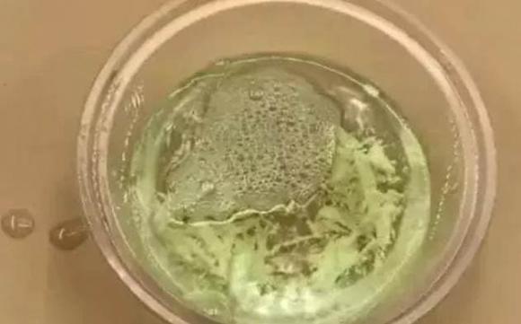 Sử dụng baking soda tốt hơn hương muỗi, an toàn và không độc hại, muỗi sẽ không đến đốt bạn suốt đêm nữa-3