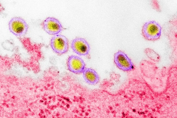 Lời cảnh báo cho đại dịch Covid-19 nhìn từ chủng HIV mới-1