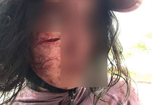 Đi làm thủ tục ly hôn, người vợ bị chồng chặn đường rạch mặt