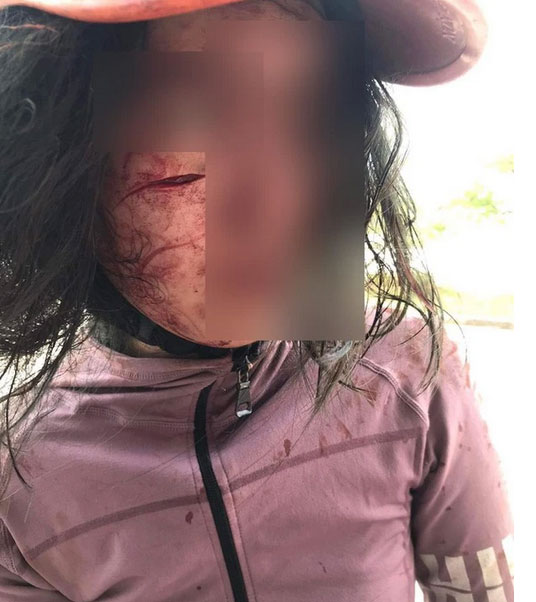 Đi làm thủ tục ly hôn, người vợ bị chồng chặn đường rạch mặt-1