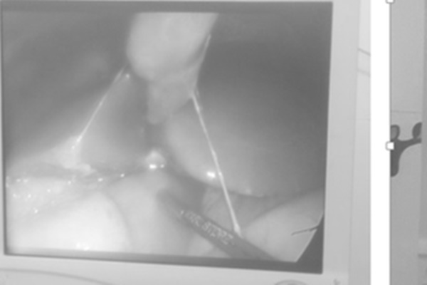 Đau đầu sau mắc COVID-19, chữa thế nào?-3