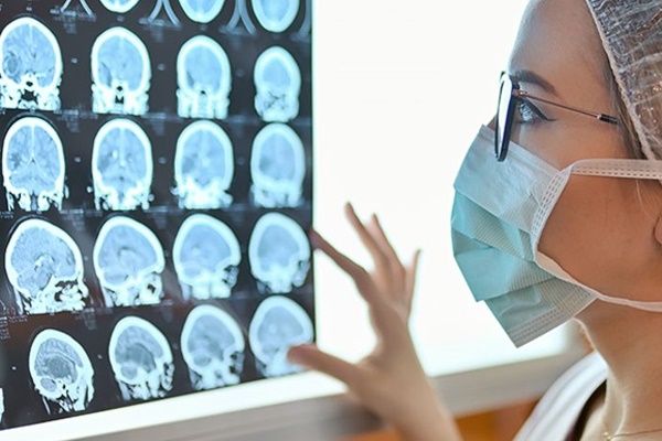 Bệnh nhân Covid-19 ít triệu chứng cũng có thể bị tổn thương não-1