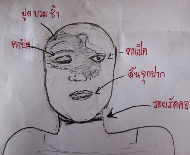 Lộ hình vẽ phác họa các vết thương đáng sợ trên gương mặt Tangmo Chiếc Lá Bay, xuất hiện cả dấu vết siết cổ?-1
