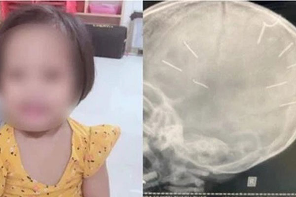 ẢNH: Thi thể bé gái 3 tuổi được trở về trong vòng tay người thân, những tiếng khóc nấc nghẹn khiến ai cũng xót xa-21