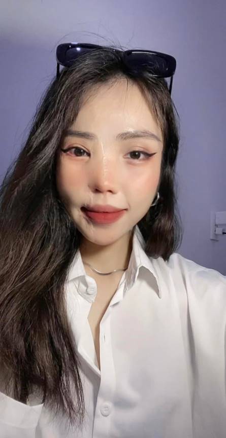 Cô gái bị chồng sắp cưới tạt axit 3 năm trước: Đã đi du học và trải qua 21 ca phẫu thuật-3