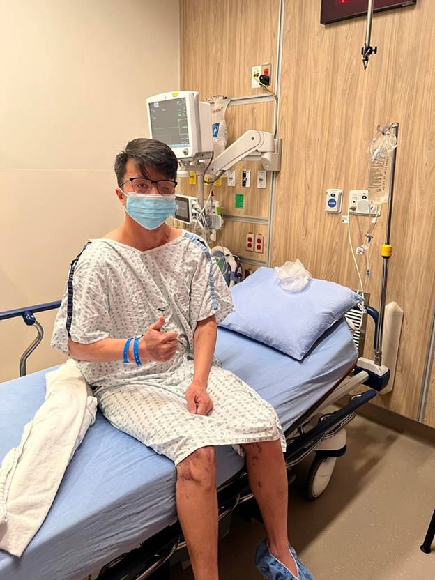 Nỗi ám ảnh kinh hoàng của Việt kiều Canada sau 3 năm bị tạt axit: Trải qua hơn 20 cuộc phẫu thuật, kẻ thủ ác vẫn nhởn nhơ nhưng có thêm niềm hạnh phúc lớn lao-3