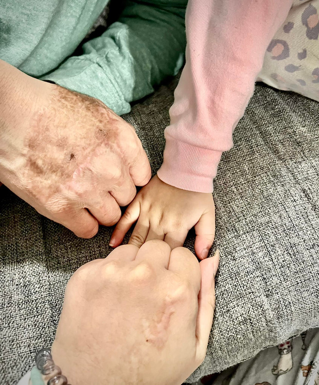 Nỗi ám ảnh kinh hoàng của Việt kiều Canada sau 3 năm bị tạt axit: Trải qua hơn 20 cuộc phẫu thuật, kẻ thủ ác vẫn nhởn nhơ nhưng có thêm niềm hạnh phúc lớn lao-5