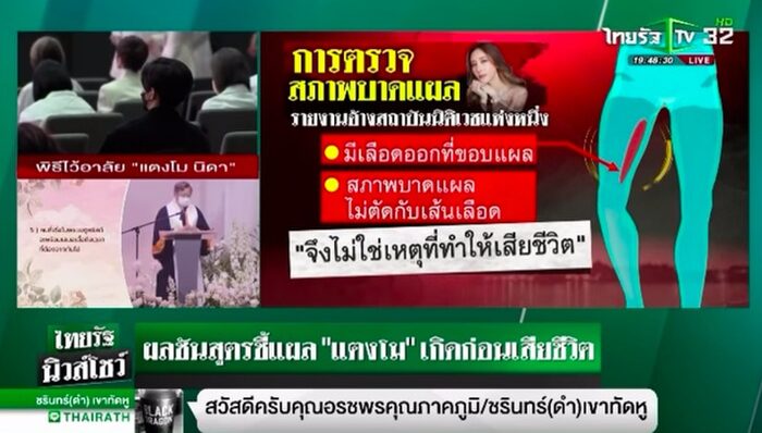 Kết quả khám nghiệm tử thi Nữ diễn viên Chiếc lá cuốn bay: Trái ngược hoàn toàn so với tin đồn-2