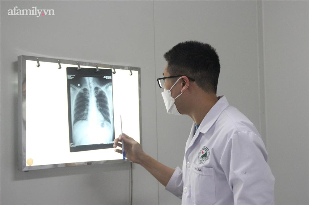 Mắc COVID-19 nhẹ nhưng hậu covid-19 người bệnh vẫn hụt hơi, khó thở, bác sĩ chỉ ra nguyên nhân-2