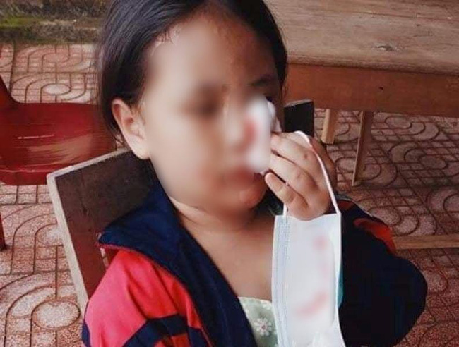 Xôn xao hình ảnh bé gái 8 tuổi người đầy máu sau khi lấy mẫu test nhanh COVID-19-1