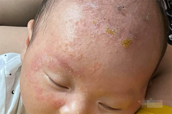 Nhạc sĩ Ngọc Châu qua đời ở tuổi 55: Căn bệnh anh mắc phải rất nguy hiểm, ngày càng nhiều người trẻ bị-6