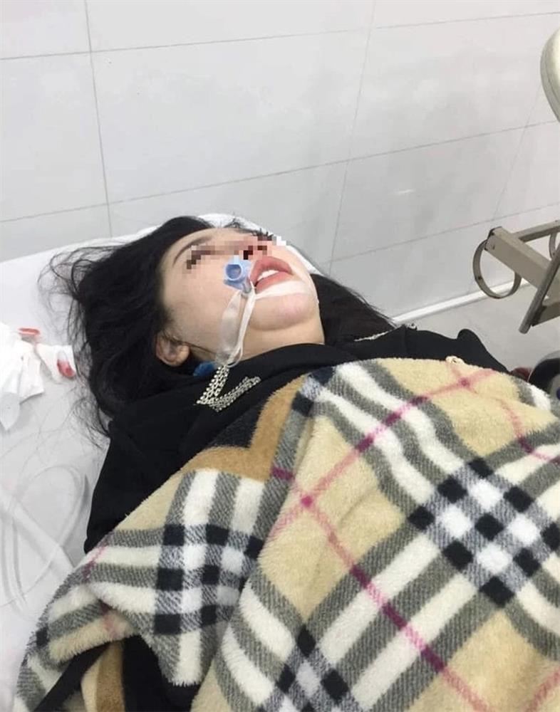 Cô gái 22 tuổi xinh đẹp đã tử vong sau khi nâng mũi | Tin tức Online