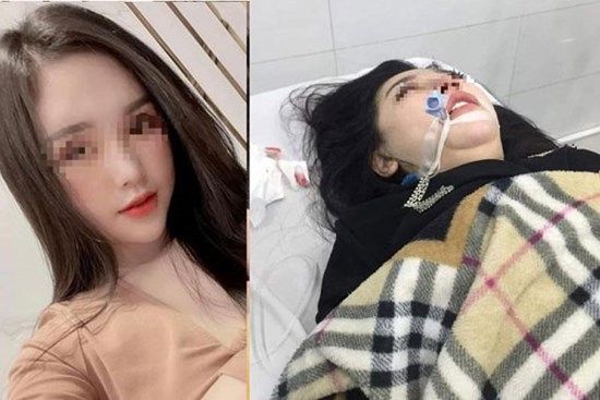 Cô gái 22 tuổi xinh đẹp đã tử vong sau 2 tháng hôn mê do phẫu thuật nâng mũi tại Hà Nội