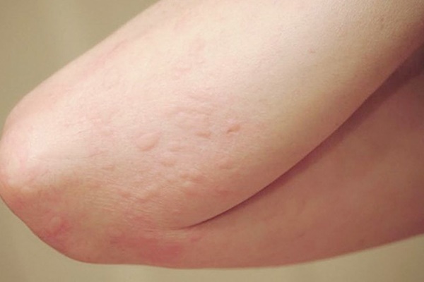 Sự nguy hiểm của biến chủng Covid-19 mới xuất hiện ở nhiều nước-4