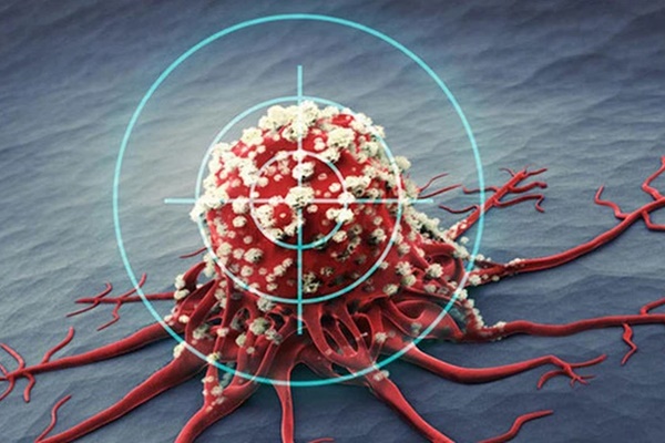 Mất bao lâu để chuyển từ viêm sang ung thư: có 3 loại viêm bạn nhất định không được chủ quan bỏ qua-1