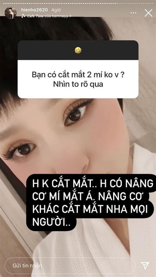 Hiền Hồ: Tiêm má baby, làm răng sứ, nâng cơ mí mắt và tiêm 0,3cc Filler vào mũi để có được nhan sắc... cứng đơ-6