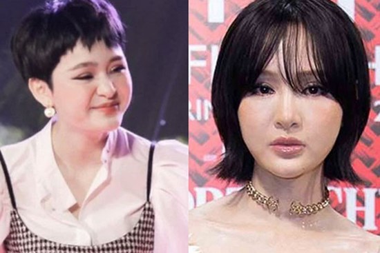 Hiền Hồ: Tiêm má baby, làm răng sứ, nâng cơ mí mắt và tiêm 0,3cc Filler vào mũi để có được nhan sắc... cứng đơ