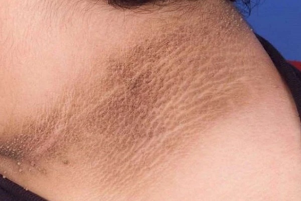 Không phân biệt nam hay nữ, nếu trên cổ xuất hiện 3 điểm bất thường thì chứng tỏ tế bào ung thư đang âm thầm tìm đến-1