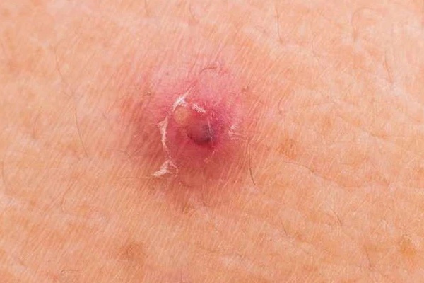 Không phân biệt nam hay nữ, nếu trên cổ xuất hiện 3 điểm bất thường thì chứng tỏ tế bào ung thư đang âm thầm tìm đến-2