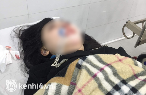Vụ cô gái 22 tuổi tử vong do PTTM: Bệnh viện Ung bướu Hà Nội nói gì về bác sĩ tiền mê?-1