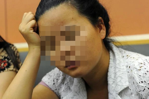 5 biểu hiện trên cơ thể cho thấy gan đang gửi tín hiệu cầu cứu, cần đi kiểm tra kịp thời, đừng để chậm trễ-4