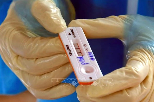 Những ai có nguy cơ cao bị tái nhiễm SARS-CoV-2?-1