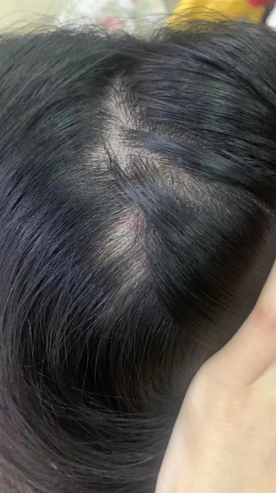 TP.HCM: Bé gái nghi bị mẹ ruột bạo hành dã man suốt 4 năm cùng lời nức nở Mẹ đánh chết con đi, đánh chết con cũng được, dì ruột cầu cứu CĐM-2