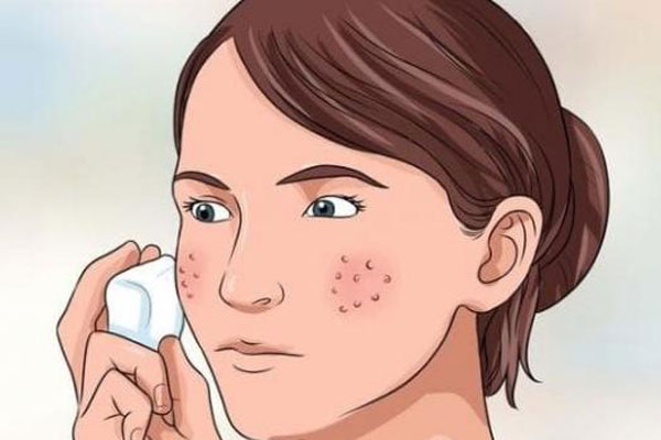 Nữ chính Twenty Five, Twenty One 32 tuổi vẫn vào vai nữ sinh ngọt lịm: Chiêu trẻ hóa từ bước làm sạch đến Son Ye Jin cũng làm theo-13