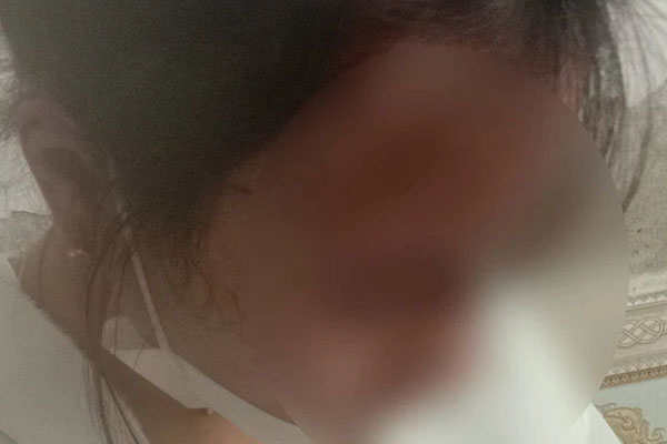 Đến ăn nhậu rồi hành hung, bắt nhân viên nhà hàng đứng xếp hàng để đánh-2