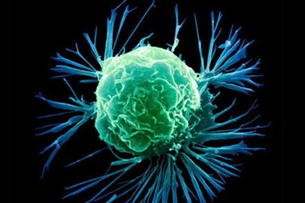 Tế bào ung thư cực ghét 5 loại thực phẩm có tính kiềm, ăn thường xuyên hàng ngày thì chẳng lo bệnh tật gõ cửa-6