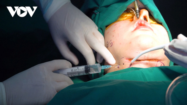 Tiêm tan mỡ nọng cằm, cô gái phải cứa cổ vì bị áp xe, hoại tử vùng cổ-1