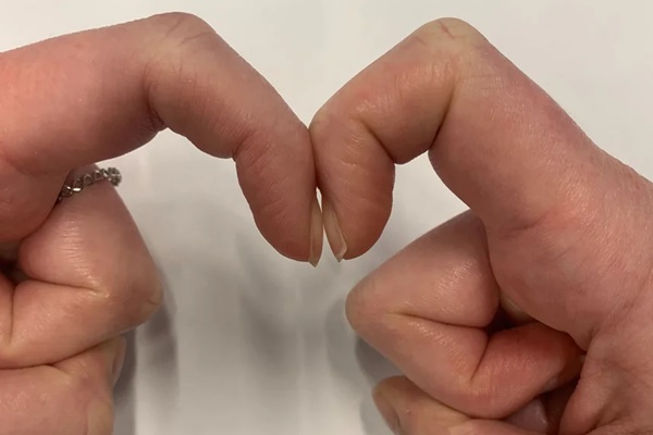 Người phụ nữ chỉ ở nhà nội trợ, chưa từng hút thuốc nhưng lại tử vong vì ung thư phổi, bác sĩ nói có 3 yếu tố nguy hiểm thì đều mắc phải-5