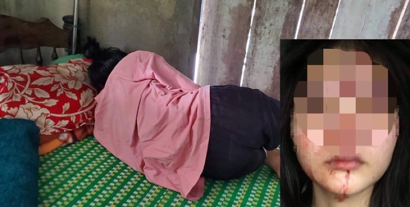 Lộ nguyên nhân nữ sinh lớp 10 ở Huế bị bạn đánh chấn động não-1